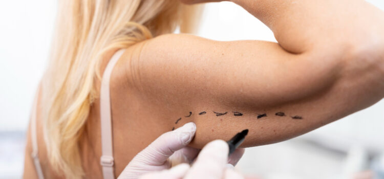 Czy endermologia jest skuteczna?